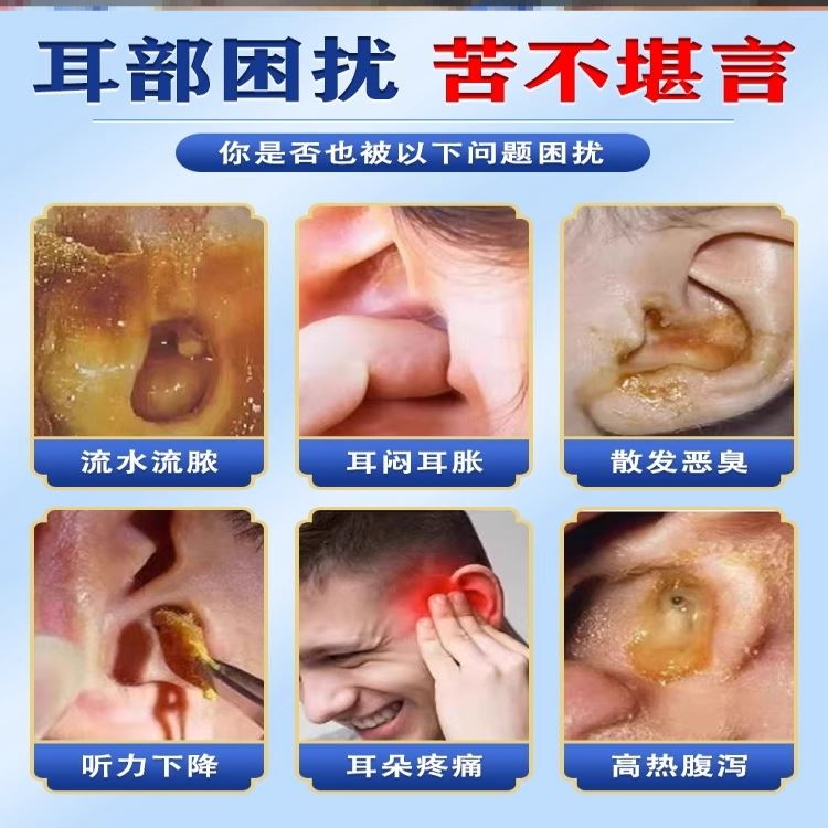 真菌感染滴耳液中耳炎专用耳塞左氟氧沙星滴耳液防水耳塞中耳炎