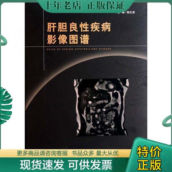 正版包邮肝胆良性疾病影像图谱 9787548102496 程红岩主编 上海第二军医大学出版社