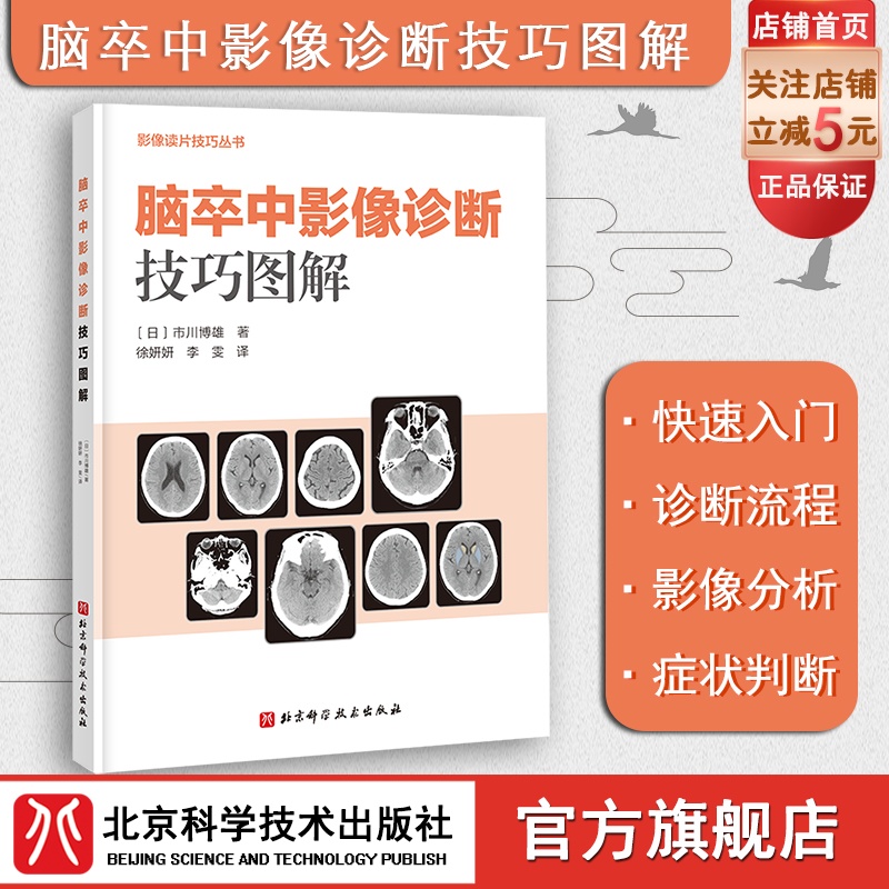脑卒中影像诊断技巧图解 影像诊断 读片技巧 影像解剖 北京科学技术