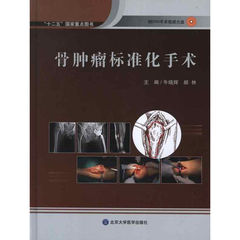 骨肿瘤标准化图谱 牛晓辉 等编 著 北京大学医学出版社