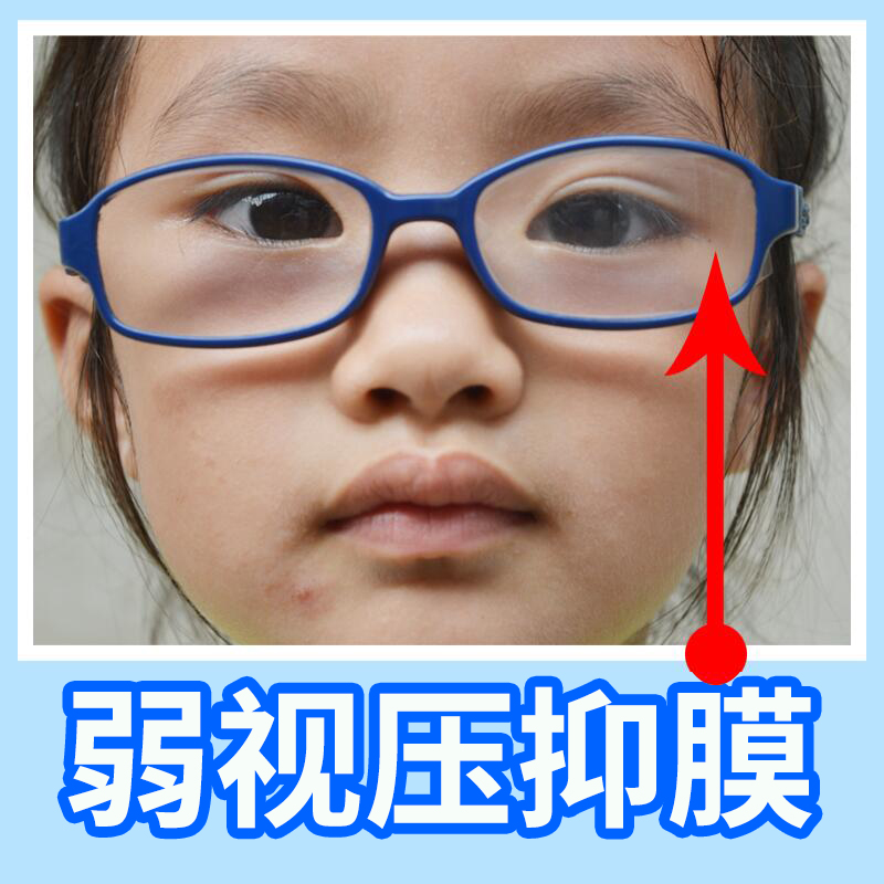 儿童单眼弱视压抑膜半透明全遮盖布隐形眼罩眼贴压贴膜眼镜遮挡贴