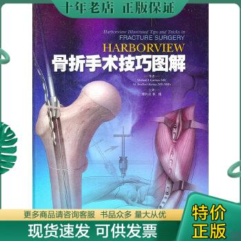 正版包邮Harborview 骨折手术技巧图解（3架） 9787547807194 （美）加德纳,（美）亨利著,张长青,张伟译 上海科学技术出版社