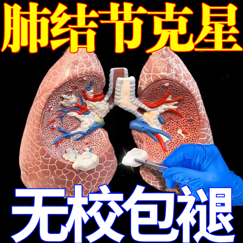 速发肺结节专用药慢阻肺特效贴中医治疗肺结节的中成药清除肺结节