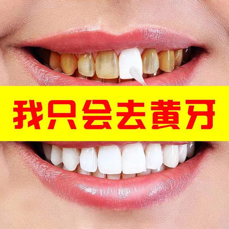 仁和溶菌酶去牙结石牙膏美白去黄去口臭溶解牙石速效洗白除器正品
