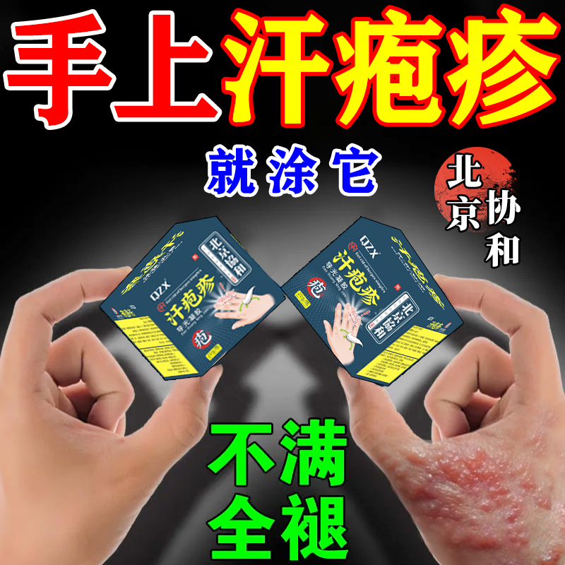 北京协和手上起小水泡汗状疱疹止痒汉状真菌感染手痒脱皮专用软膏
